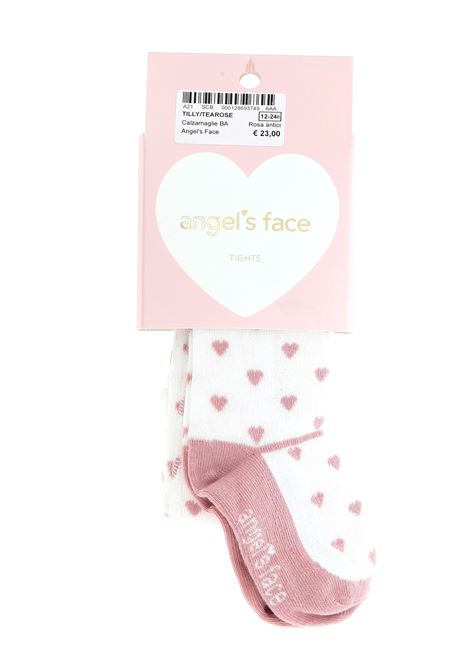  Angel's Face | TILLYTEAROSE